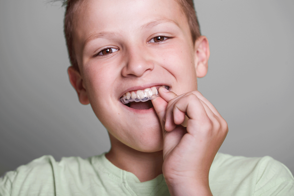 Boy Placing Clear Aligner In His Mouth