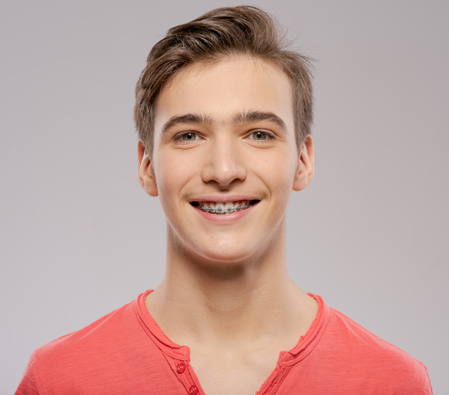 Smiling Teen Boy With Braces On His Teeth. Close Up Portrait Of A Beautiful Young Boy With Even Healthy Teeth.
