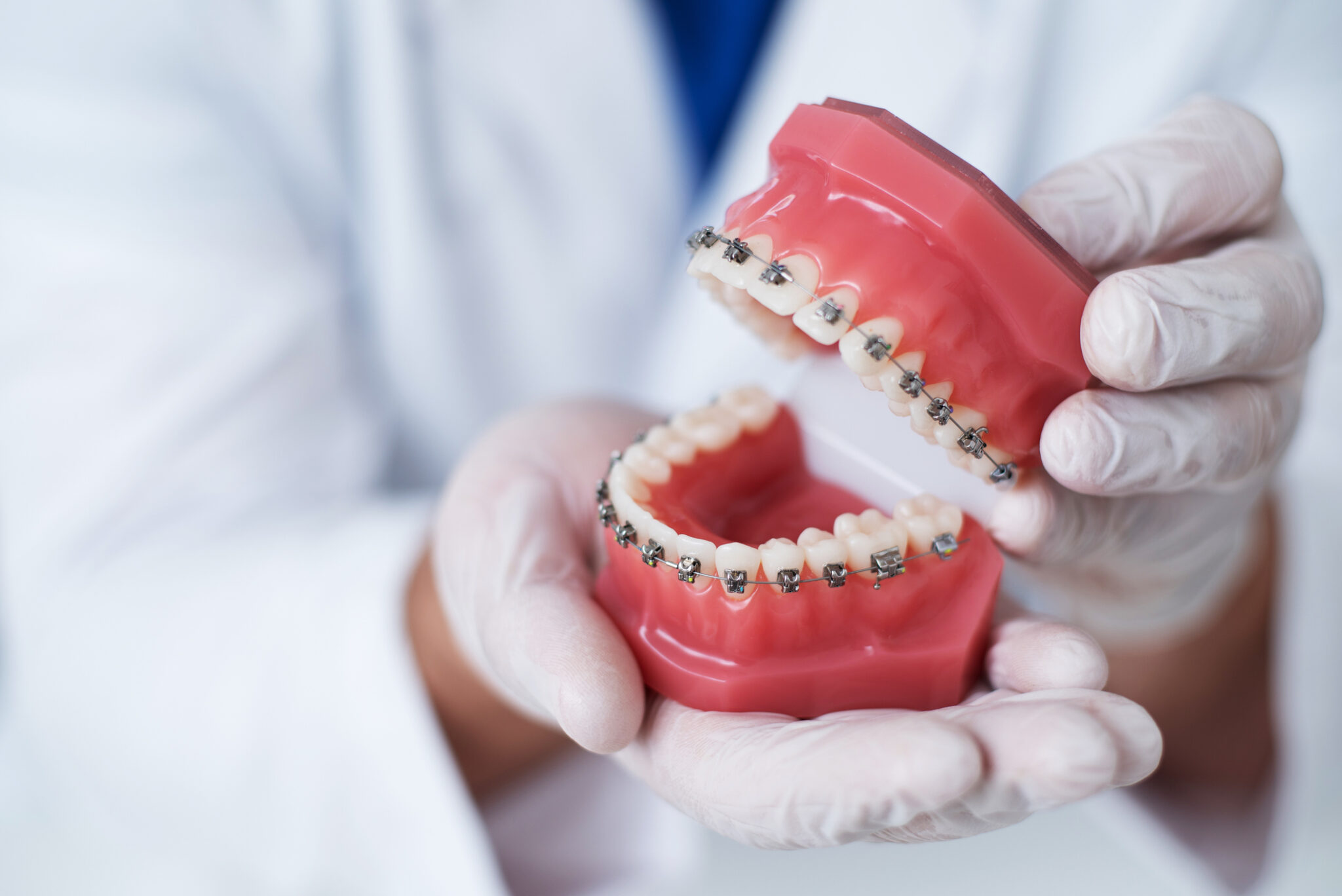 Orthodontist in St. Louis, MO Shows How The System Of Braces On Teeth Is Arranged