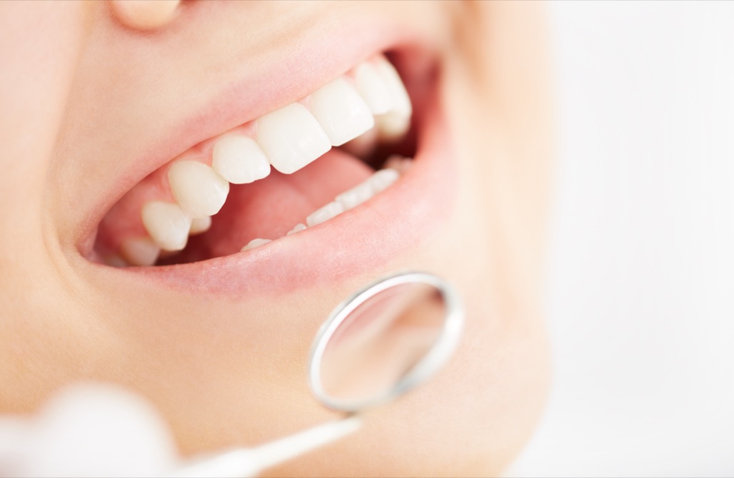 close up of orthodontist examining patient