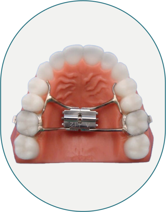 Close Up Of Teeth Model Utilizing Dentofacial Expansion